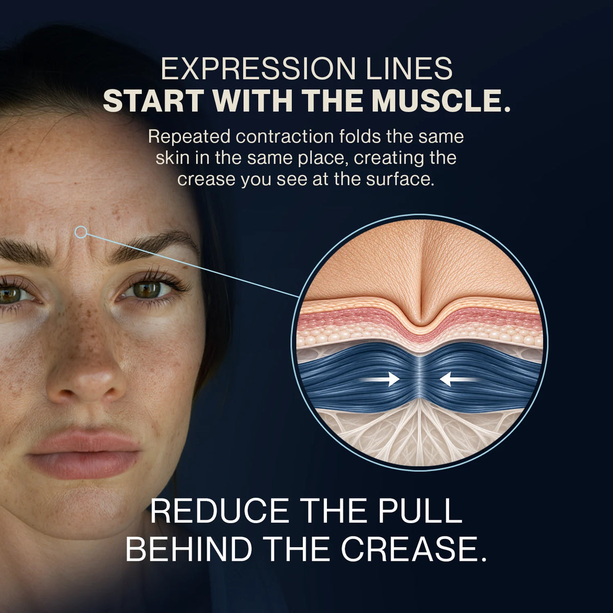 Expression lines and the crease you see at the surface