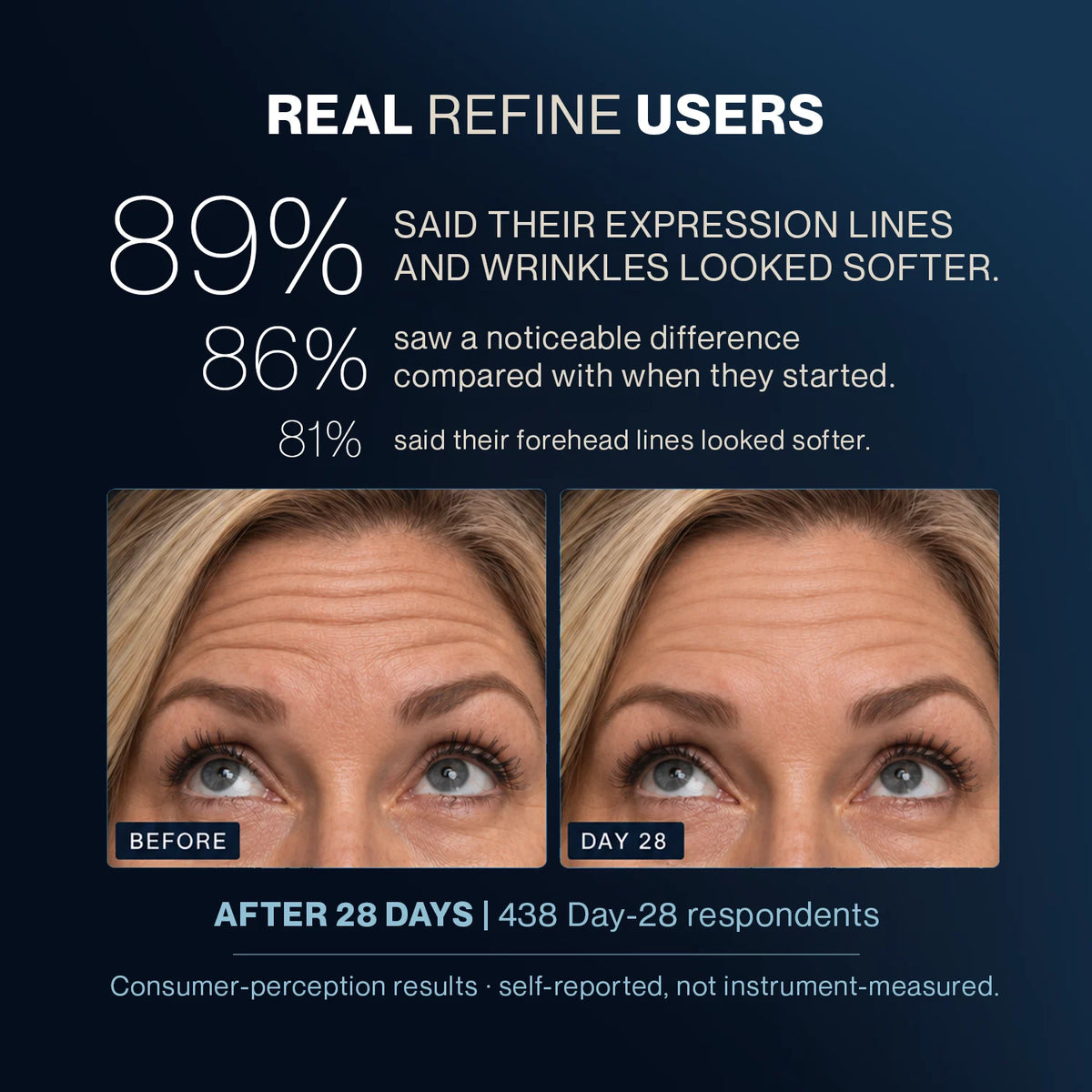 What real REFINE users reported after 28 days, with forehead photos before and at day 28