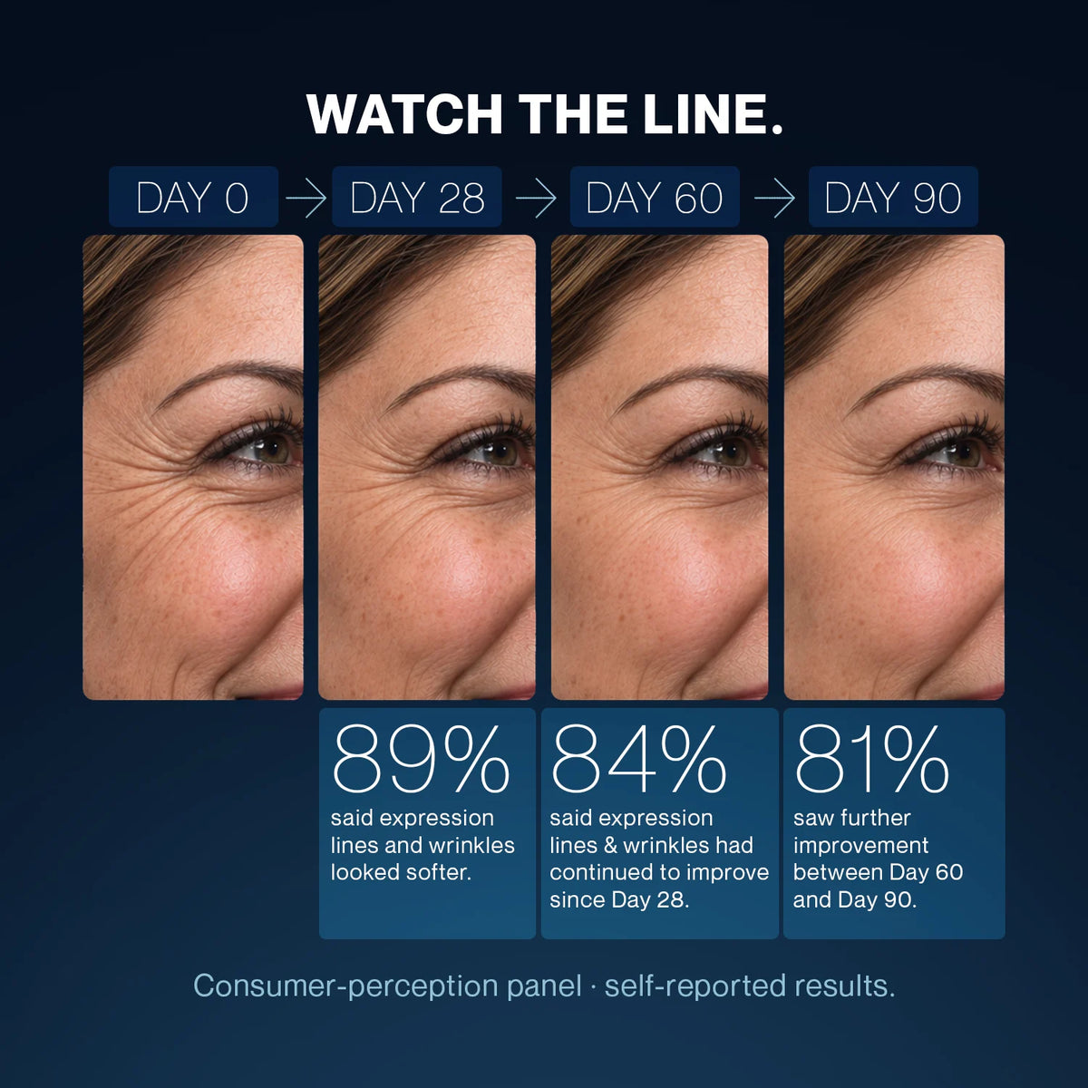 Crow's feet at day 0, 28, 60 and 90, with consumer panel results