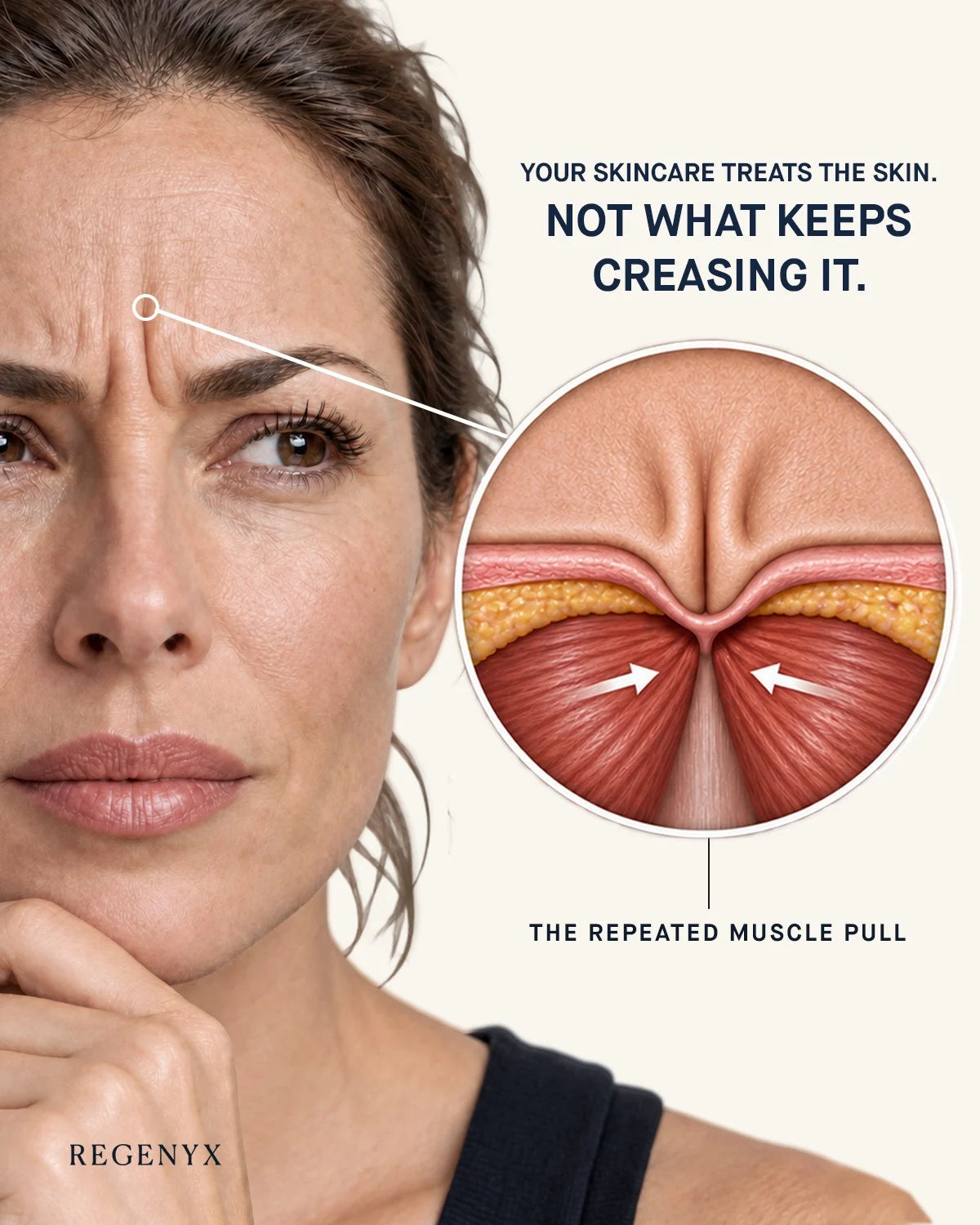 Your skincare treats the skin, not what keeps creasing it: the repeated muscle pull behind a forehead line